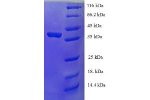 Upstream Transcription Factor 1 (USF1) (AA 3-310), (partial) protein (His tag)