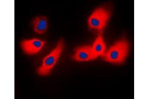 Immunofluorescent analysis of Cytochrome P450 2A6 staining in HeLa cells.