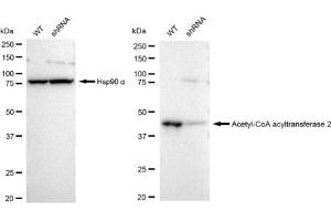 Western blotting analysis using Acetyl-CoA acyltransferase 2 antibody (ABIN7797441).
