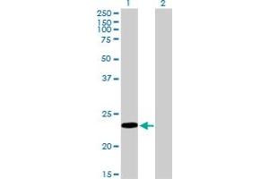 Western Blot analysis of RBP4 expression in transfected 293T cell line by RBP4 monoclonal antibody (M01), clone 1E9. (RBP4 antibody  (AA 19-201))
