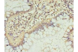 Immunohistochemistry of paraffin-embedded human small intestine tissue using ABIN7151719 at dilution of 1:100 (ZC3H12A antibody  (AA 1-260))