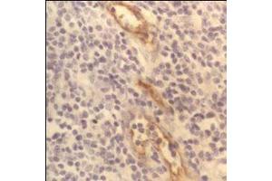 CD62P (P-Selectin) – ABIN118767 - Human tonsil showing capillary endothelium. (P-Selectin antibody)