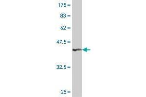 Western Blot detection against Immunogen (36. (EMSY antibody  (AA 1081-1178))