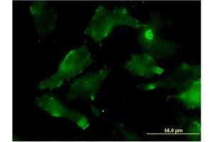 Immunofluorescence of monoclonal antibody to HSD17B7 on HeLa cell. (HSD17B7 antibody  (AA 255-341))