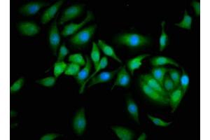 Immunofluorescence staining of A549 cells with ABIN7146551 at 1:166, counter-stained with DAPI.