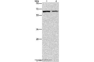 Western blot analysis of Mouse pancreas and human fetal liver tissue, using CBS Polyclonal Antibody at dilution of 1:550 (CBS antibody)