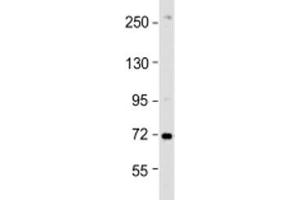 Western blot testing of HeLa cell lysate with ZDHHC17 antibody at 1:1000. (ZDHHC17 antibody  (AA 3-37))