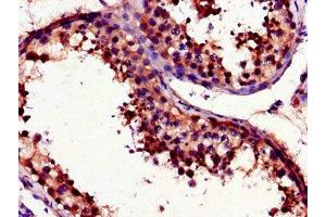 Immunohistochemistry of paraffin-embedded human testis tissue using ABIN7175097 at dilution of 1:100 (UNG antibody  (AA 114-224))