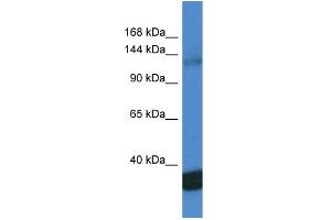 WB Suggested Anti-PPP1R12A AntibodyTitration: 1. (PPP1R12A antibody  (C-Term))