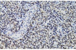 Immunohistochemistry of paraffin-embedded Human tonsil using TMPO Polyclonal Antibody at dilution of 1:100 (40x lens). (Thymopoietin antibody)