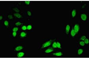 Immunofluorescent analysis of HepG2 cells using ABIN7142468 at dilution of 1:100 and Alexa Fluor 488-congugated AffiniPure Goat Anti-Rabbit IgG(H+L) (HPD antibody  (AA 2-393))