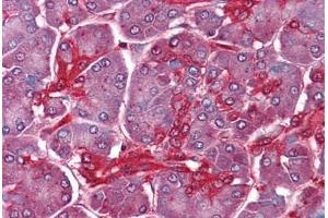 Human Pancreas: Formalin-Fixed, Paraffin-Embedded (FFPE) (CLIC1 antibody  (AA 1-242))