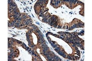 Immunohistochemical staining of paraffin-embedded liver tissue using anti-SRRmouse monoclonal antibody. (SRR antibody)