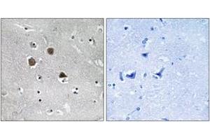 Immunohistochemistry analysis of paraffin-embedded human brain tissue, using MARK1/2/3/4 (Ab-215) Antibody. (MARK1/2/3/4 antibody  (AA 181-230))