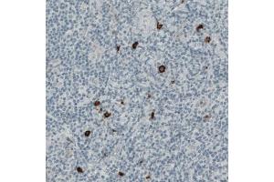 Immunohistochemical staining (Formalin-fixed paraffin-embedded sections) of human tonsil with KIT monoclonal antibody, clone CL1667  shows strong positivity in a subset of lymphoid cells.