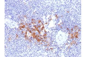 Formalin-fixed, paraffin-embedded human Spleen stained with TRAF1 Mouse Monoclonal Antibody (TRAF1/2770). (TRAF1 antibody  (AA 73-219))