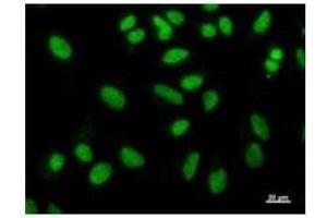 Immunostaining analysis in HeLa cells. (NAB1 antibody)
