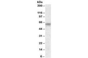 Western blot testing of human testis lysate with TTC8 antibody at 0. (TTC8 antibody)