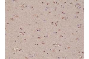IHC testing of formalin fixed and paraffin embedded human brain tissue with recombinant S100B antibody at 1:1000 dilution. (Recombinant S100B antibody  (C-Term))