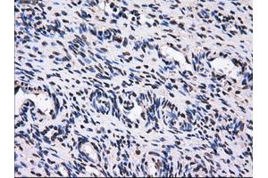 Immunohistochemical staining of paraffin-embedded colon tissue using anti-GBE1mouse monoclonal antibody.