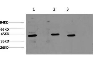 Western Blotting (WB) image for anti-Actin, alpha 1, Skeletal Muscle (ACTA1) antibody (ABIN5958079) (Actin antibody)