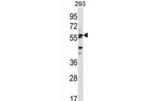 Western Blotting (WB) image for anti-Sialic Acid Binding Ig-Like Lectin 6 (SIGLEC6) antibody (ABIN2998617) (SIGLEC6 antibody)