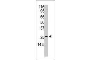 Western blot analysis of APH1A polyclonal antibody  in A2058 cell lysate (35 ug/lane).