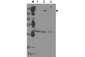 Image no. 1 for anti-Tumor Protein P53 Binding Protein 2 (TP53BP2) antibody (ABIN401045) (TP53BP2 antibody)