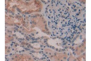 DAB staining on IHC-P; Samples: Human Kidney Tissue (AMBP antibody  (AA 22-203))
