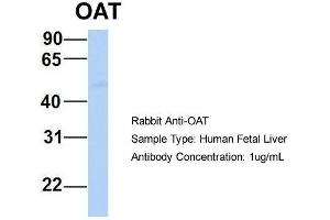 Host:  Rabbit  Target Name:  OAT  Sample Type:  Human Fetal Liver  Antibody Dilution:  1. (OAT antibody  (Middle Region))