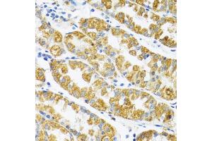 Immunohistochemistry of paraffin-embedded human stomach using POLG2 antibody (ABIN5974040) at dilution of 1/100 (40x lens). (POLG2 antibody)