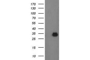 Western Blotting (WB) image for anti-Phenylethanolamine N-Methyltransferase (PNMT) antibody (ABIN1500309)