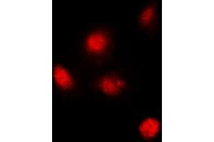 Immunofluorescent analysis of SUPT3H staining in MCF7 cells. (SUPT3H/SPT3 antibody  (Center))
