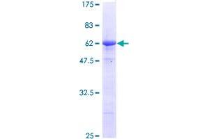 Stanniocalcin 2 Protein (STC2) (AA 1-302) (GST tag)