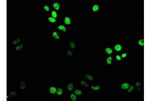 Immunofluorescence staining of PC-3 cells with ABIN7164186 at 1:133, counter-stained with DAPI. (XAB2 antibody  (AA 750-840))
