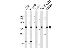 All lanes : Anti-Cyclophilin D Antibody at 1:2000 dilution Lane 1: K562 whole cell lysate Lane 2: HepG2 whole cell lysate Lane 3: Jurkat whole cell lysate Lane 4: CCRF-CEM whole cell lysate Lane 5: human brain lysate Lysates/proteins at 20 μg per lane. (PPID antibody  (AA 336-370))