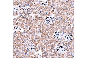 IHC analysis of p57 Kip2/CDKN1C using anti-p57 Kip2/CDKN1C antibody (ABIN7603232). (CDKN1C antibody  (N-Term))