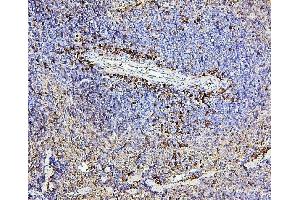 IHC analysis of CD43 using anti-CD43 antibody (ABIN7601042). (CD43 antibody  (AA 272-400))