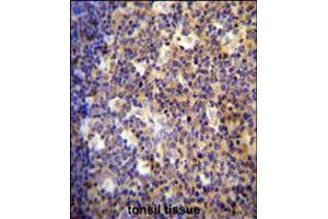 ALOX12B antibody immunohistochemistry analysis in formalin fixed and paraffin embedded human tonsil tissue followed by peroxidase conjugation of the secondary antibody and DAB staining. (ALOX12B antibody  (C-Term))