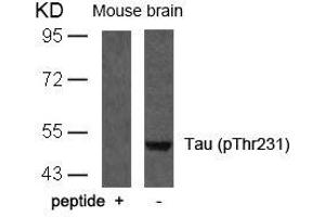 Western blot analysis of extracts from mouse brain tissue using Tau(Phospho-Thr231) Antibody and the same antibody preincubated with blocking peptide. (MAPT antibody  (pThr231))