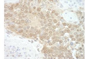Immunohistochemistry (IHC) image for anti-RuvB-Like 2 (E. Coli) (RUVBL2) (AA 1-50) antibody (ABIN7448783) (RUVBL2 antibody  (AA 1-50))