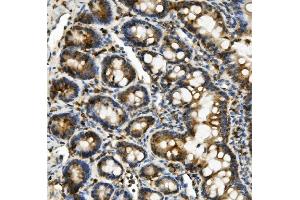 IHC analysis of Hexokinase 1/HK1 using anti-Hexokinase 1/HK1 antibody (ABIN7600259). (Hexokinase 1 antibody  (AA 17-323))