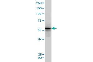 ALF monoclonal antibody (M04), clone 5B9 Western Blot analysis of ALF expression in PC-12 . (GTF2A1L antibody  (AA 251-348))