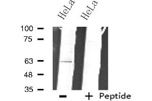 ZNF18 antibody  (C-Term)