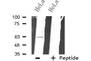 Western blot analysis of extracts from HeLa cells, using ZNF18 antibody.