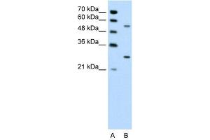 WB Suggested Anti-PDPK1 Antibody Titration: 0. (PDPK1 antibody  (Middle Region))