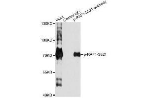 Immunoprecipitation analysis of 200 μg extracts of HeLa cells treated by EGF using 2. (RAF1 antibody  (pSer621))