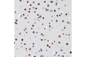 Immunohistochemistry (IHC) image for anti-Histone Deacetylase 1 (HDAC1) antibody (ABIN7267707)