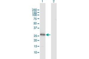 Western Blot analysis of VAPB expression in transfected 293T cell line by VAPB MaxPab polyclonal antibody.