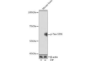 Western blot analysis of extracts of Mouse brain, using Phospho-Tau-S396 Rabbit mAb (ABIN7268523) at 1:1000 dilution. (MAPT antibody  (pSer396))